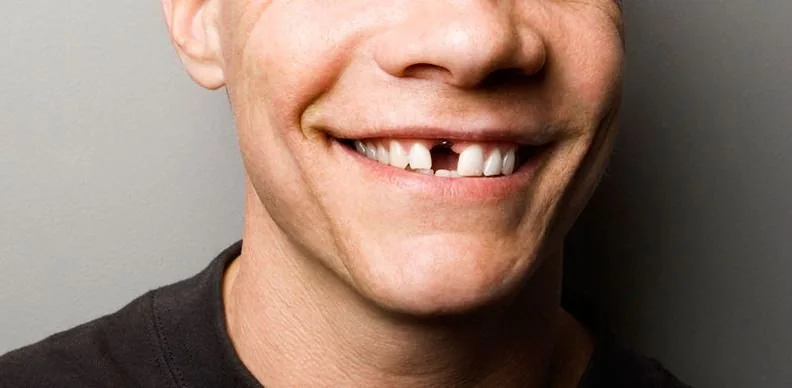 Missing tooth